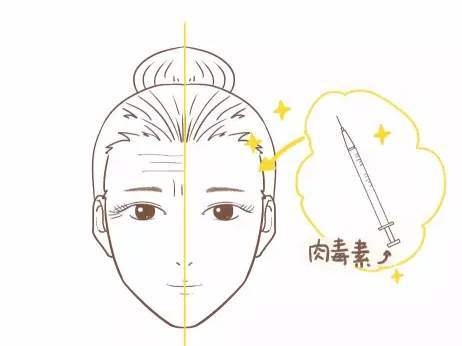 去眼角皱纹最好偏方_眼角皱纹除皱生活小窍门_眼角皱纹去除偏方大全